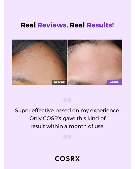 COSRX - AHA/BHA Clarifying Treatment Toner 150ml COSRX - AHA/BHA Clarifying Treatment Toner 150ml
