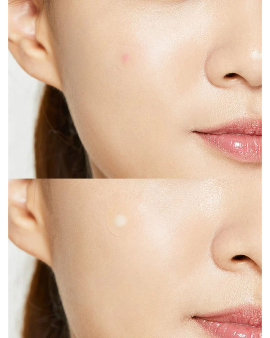 COSRX - Acne Pimple Master 24 patches