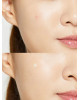 COSRX - Acne Pimple Master 24 patches