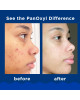 PanOxyl Acne Foaming Wash Benzoyl Peroxide 10% Maximum Strength